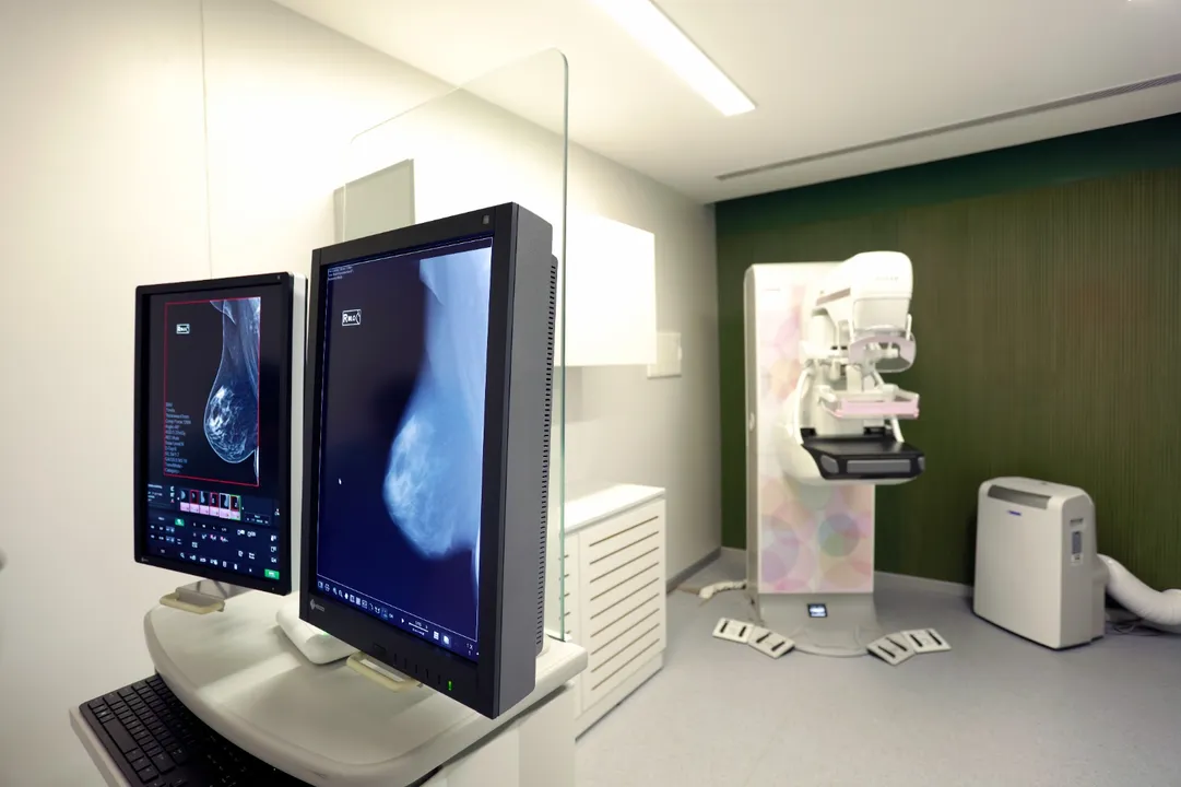 Breast Cancer Time Bomb: What India Can Learn From Japan's Early-Stage Intervention